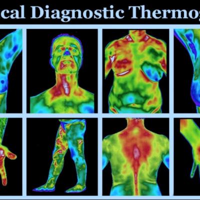 Τι είναι η Υπέρυθρη Απεικονιστική Θερμογραφία; What is Infrared Imaging Thermography?